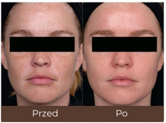 Example of individual treatment results.