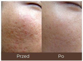 Example of individual treatment results.