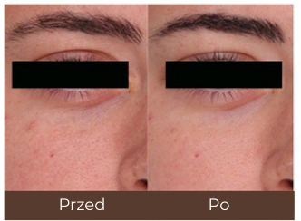 Example of individual treatment results.