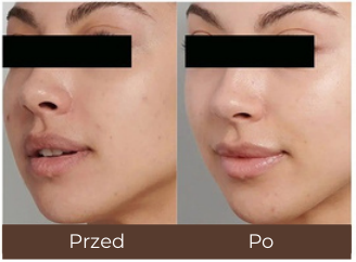Example of individual treatment results.