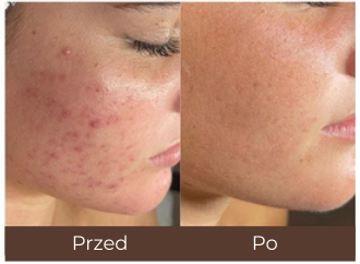 Example of individual treatment results.