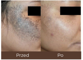 Example of individual treatment results.